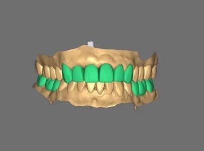 Restoration Design